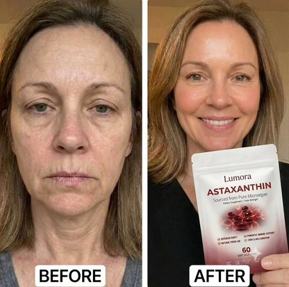 Lumora Astaxanthin